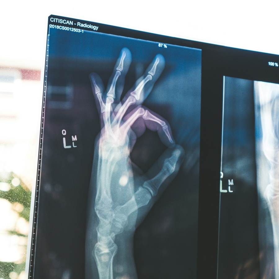xray of a hand doing the "okay" gesture